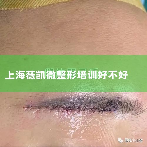 ɰ͸״ɫͨƤֳɫ󣬴ﵽڸ覴áﳤ̡ܶáѧ岻APȣ֮ǰAPѧϰʱʦĽ̵ѵҲʺɶҲȥѧ۸Ҳ